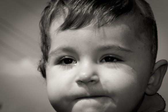 Savanna Hospital Second Resection-6135